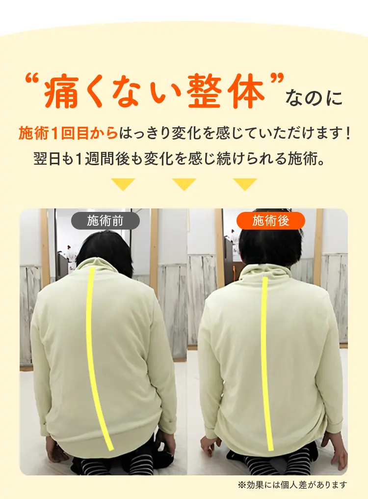 痛くない整体による施術前後の比較画像。曲がっていた背筋が1回の施術で真っ直ぐに伸びている様子。