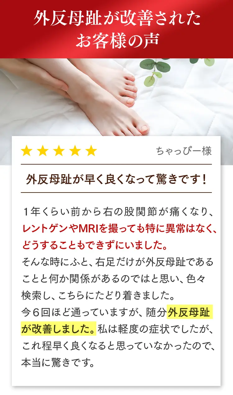 外反母趾が改善されたお客様の声。ちゃっぴー様：1年前から右股関節が痛み、レントゲン等でも異常なし。当院に通い始めて随分外反母趾が改善し、驚いています。