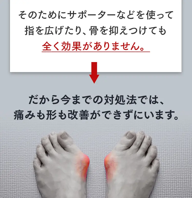 サポーターで指を広げたり骨を抑えつけても効果がない理由。従来の対処法で痛みや形が改善できない現状。