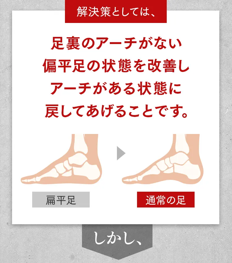 外反母趾の解決策：足裏のアーチがない偏平足を改善し、正常なアーチがある状態に戻すことの重要性（比較図）。
