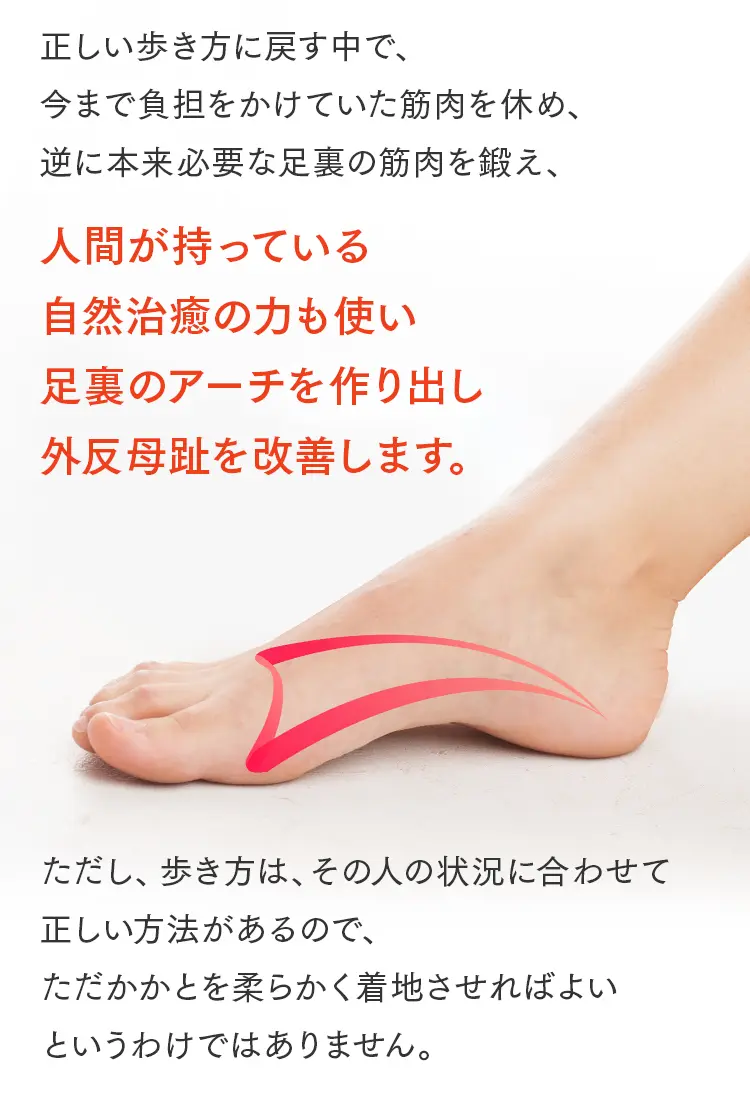 正しい歩き方で足裏のアーチを作り出し、自然治癒力を高めて外反母趾を改善。個々の状況に合わせた適切な着地方法の重要性。